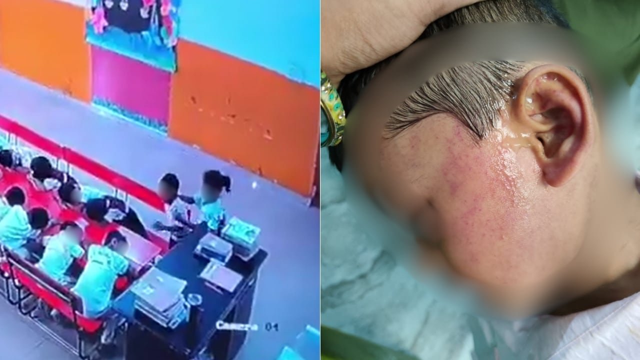 Teacher Not In Room, Class Monitor Thrashes Nursery Student For Raising Head