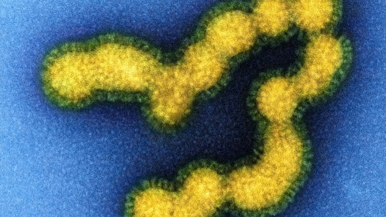Swine Flu Alert In Nagpur: Cases Rise To 15 In July, One Dead