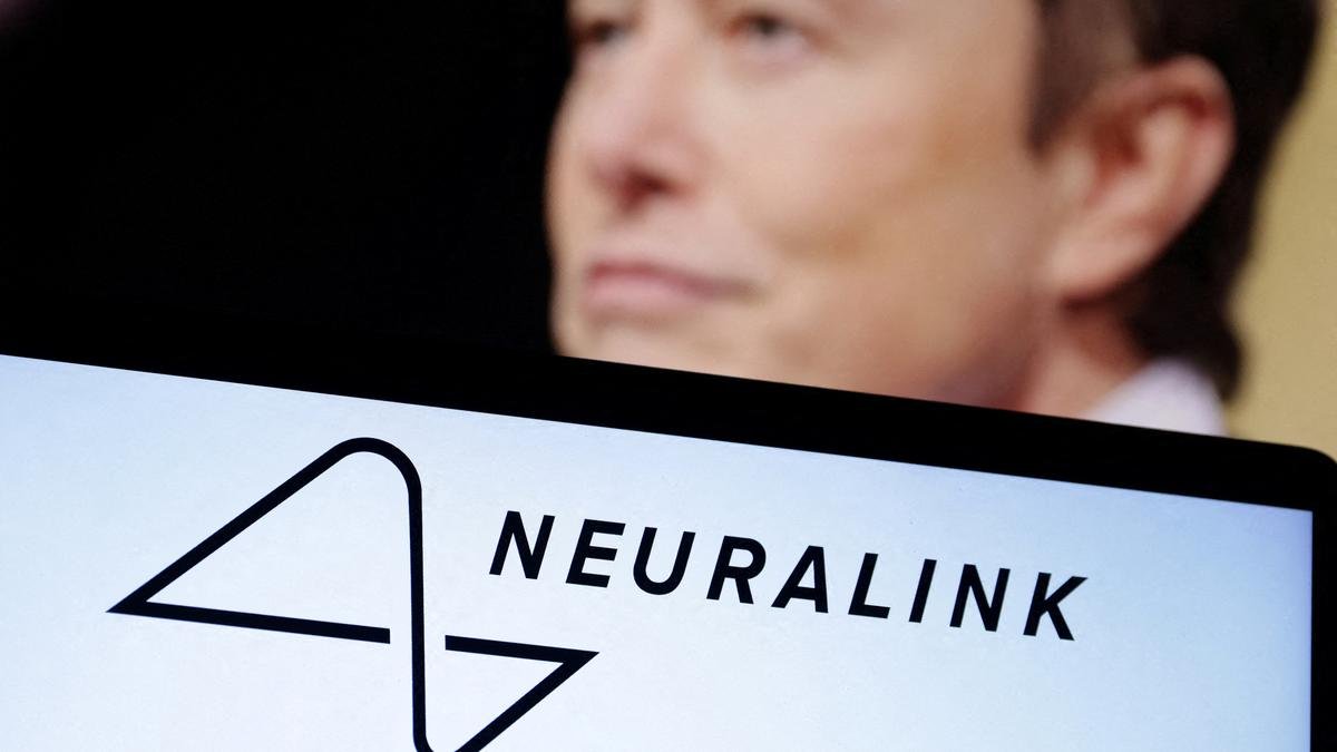 What makes the brain the most complicated object in the universe