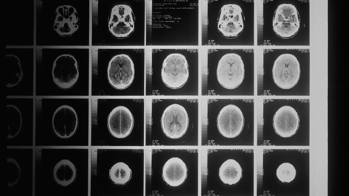 Psychedelics are revealing how the brain builds the sense of self