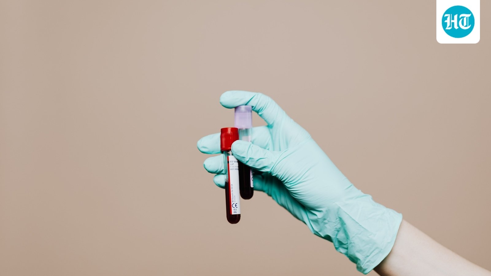 Men over 40, don't skip these health tests: Doctor shares 5 risks to screen for, from blood sugar to fatty liver