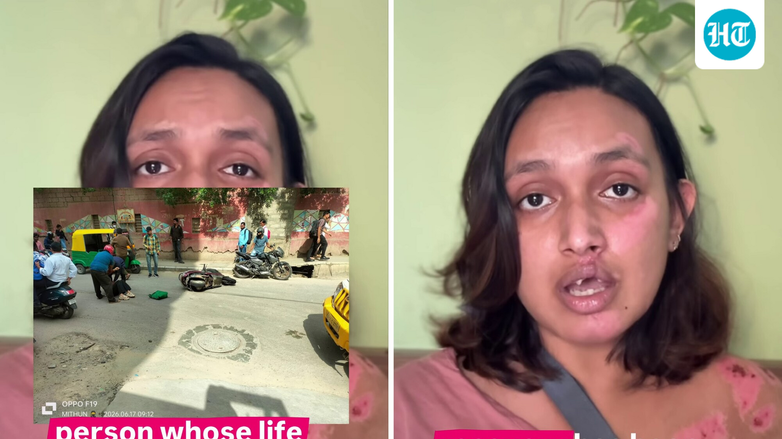 ‘Haven’t received a single rupee’: Bengaluru accident victim hits out at Rapido