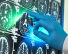 Alzheimer’s research is latest casualty in Trump administration war against ‘DEI’