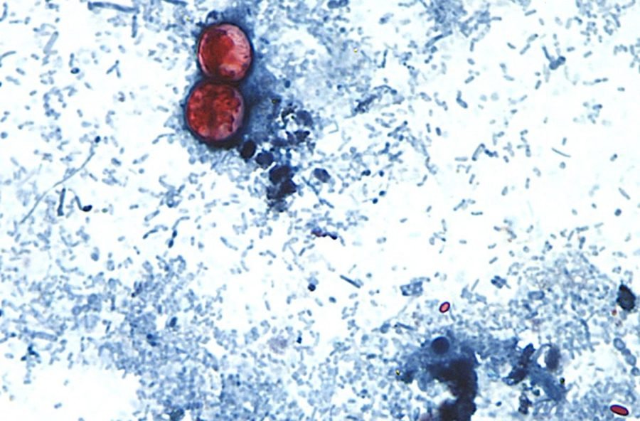 Cyclospora outbreaks with no confirmed sources grow: FDA