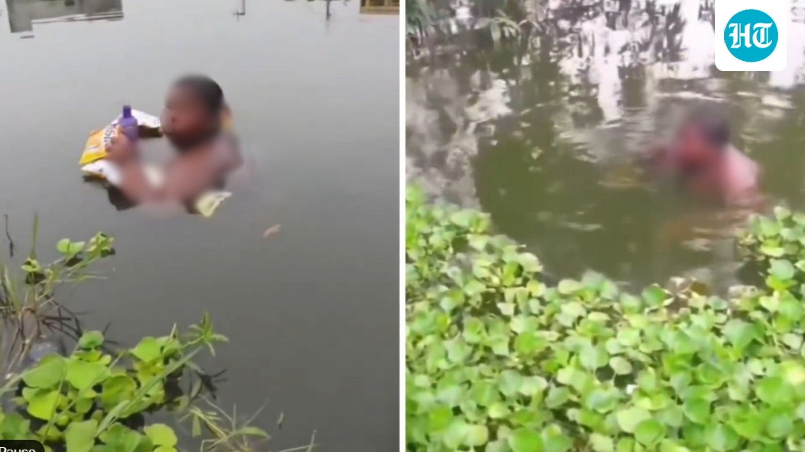West Bengal teen living in pond airlifted to Mumbai after Anant Ambani steps in
