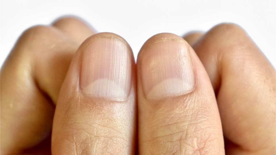 Why Do Your Fingernails Have A White Crescent? A Biologist Explains The ‘Lunula’