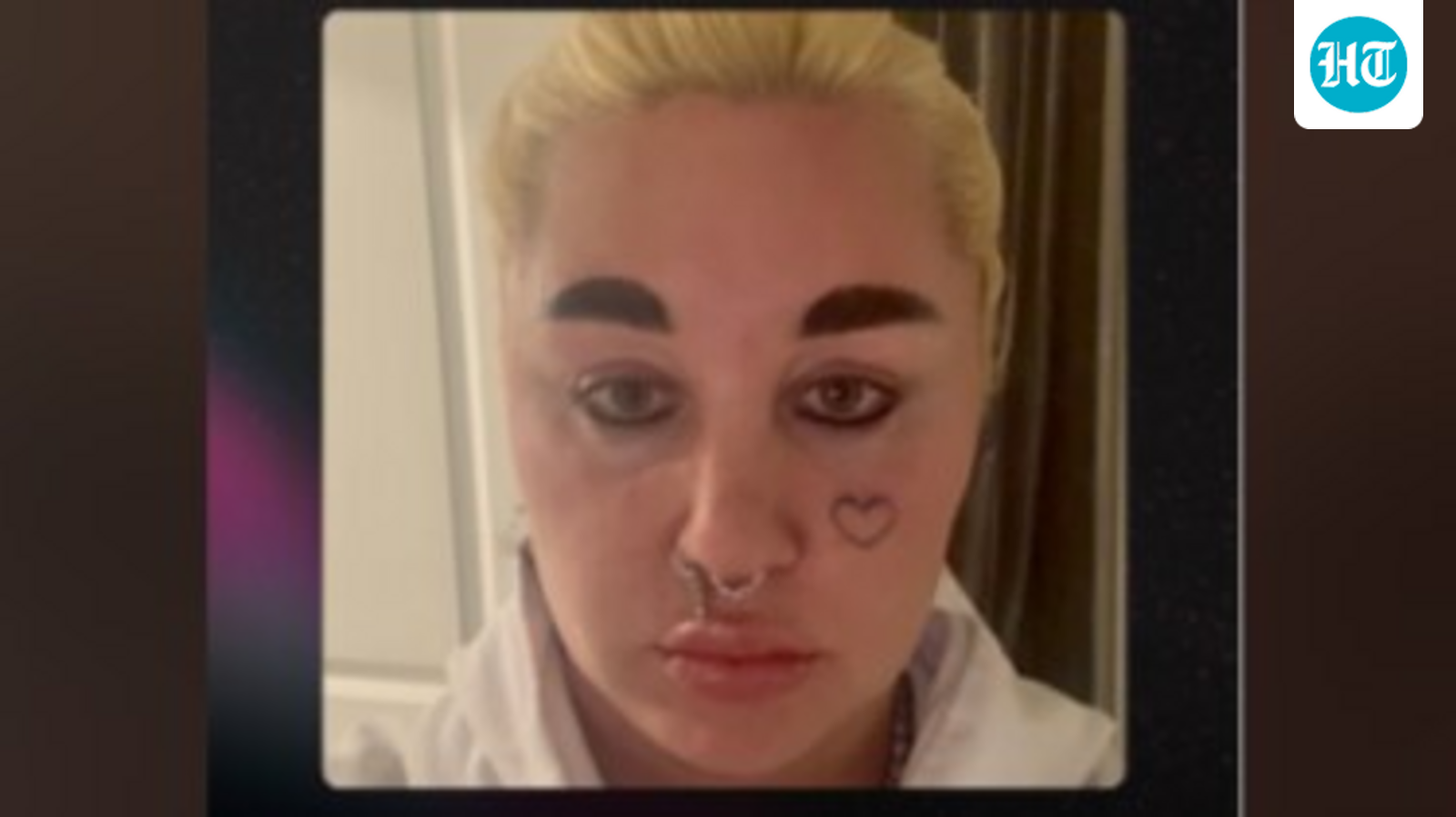 Is Amanda Bynes okay? Hayden Panettiere photo sparks concerns among fans; ‘something inside is broken’