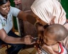 Children make up half of mpox cases in Guinea-Bissau as epidemic spreads
