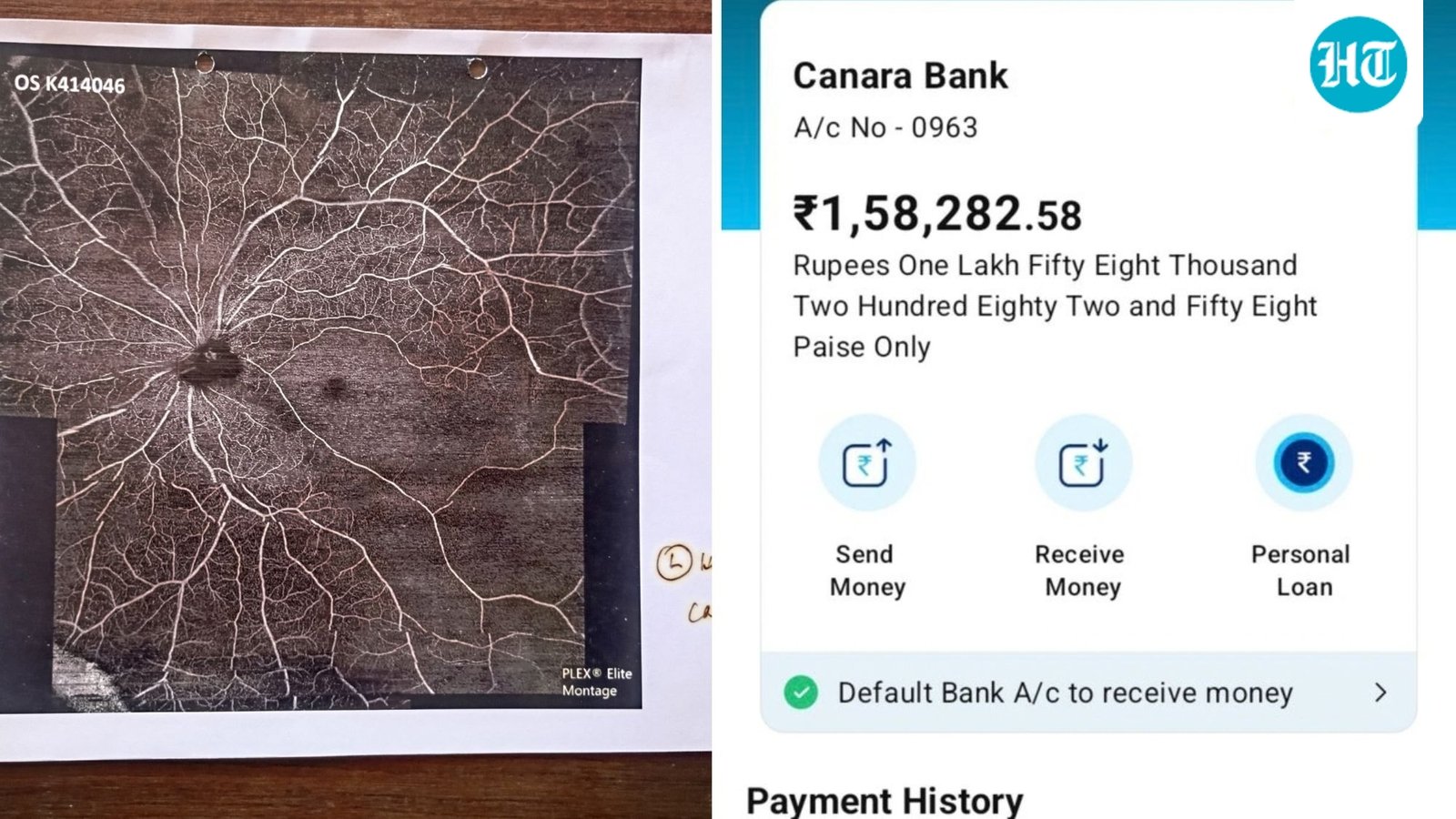 16-year-old raises  ₹1.5 lakh in 24 hours for little sister's surgery after heartfelt post goes viral